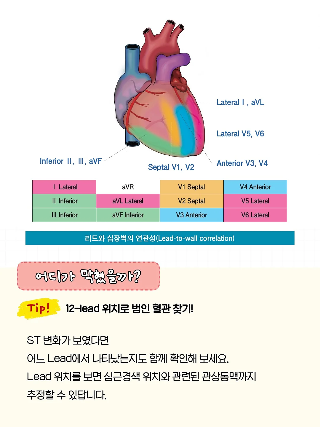 달항아리 화분 7