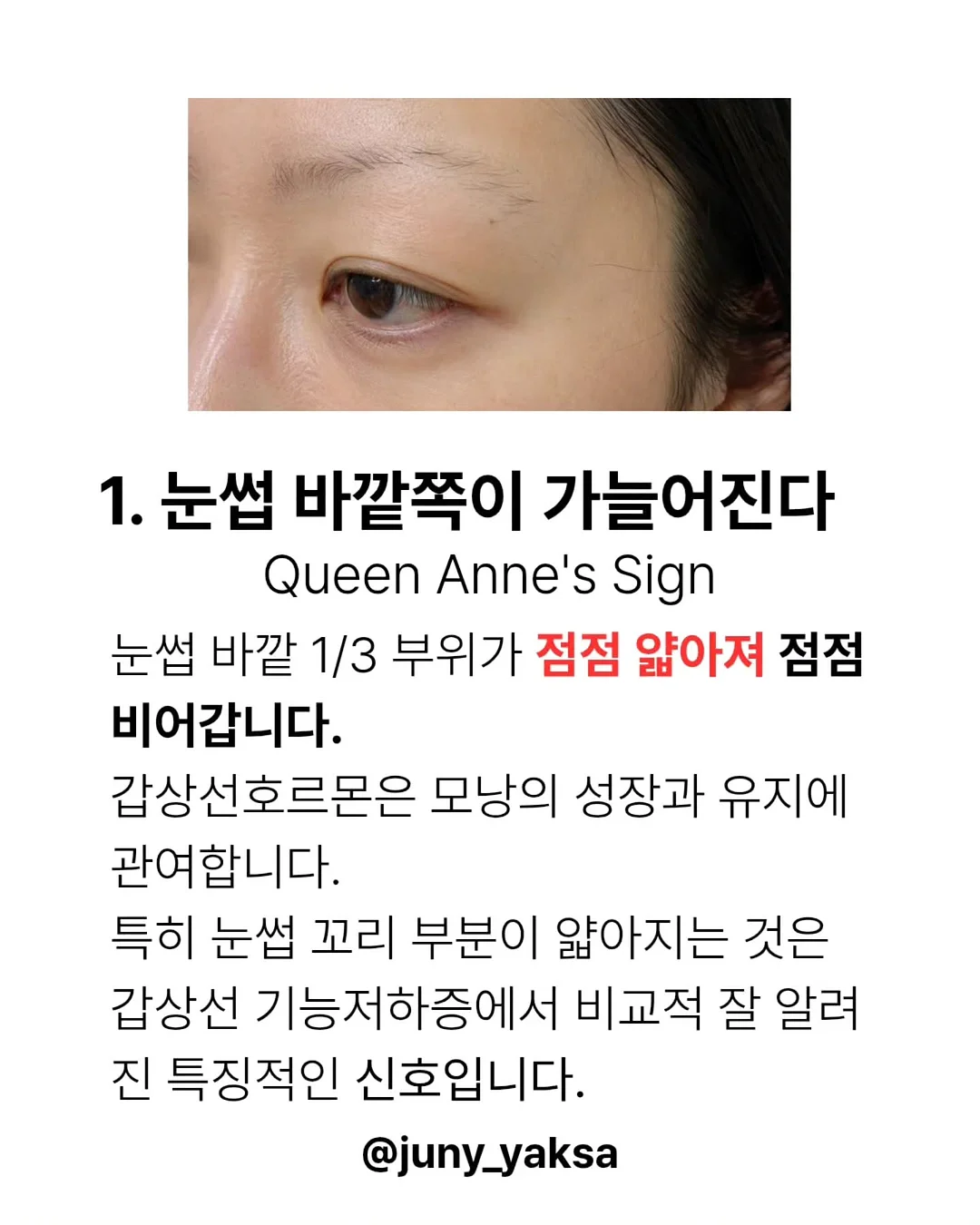 핸드폰 미니 크로스백 3