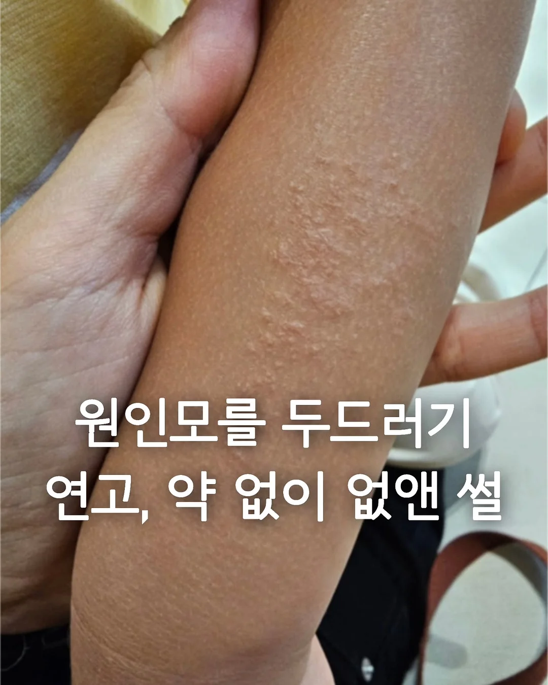 미피 손타올 1
