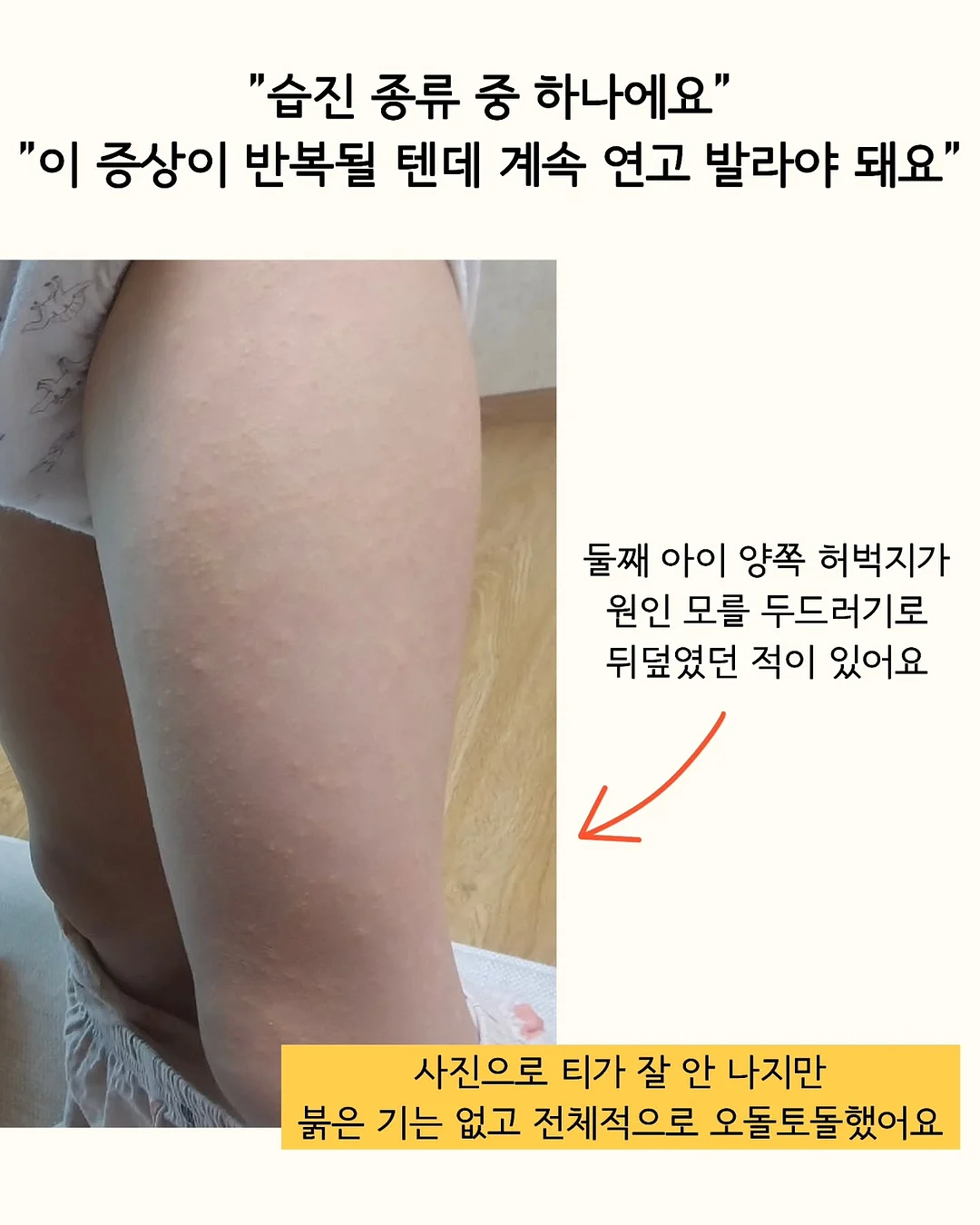 미피 손타올 2