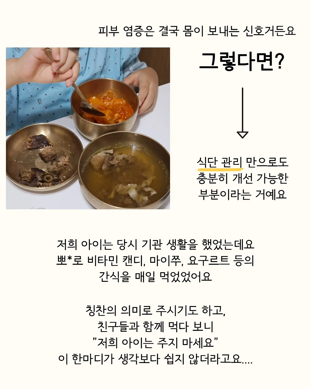 미피 손타올 4