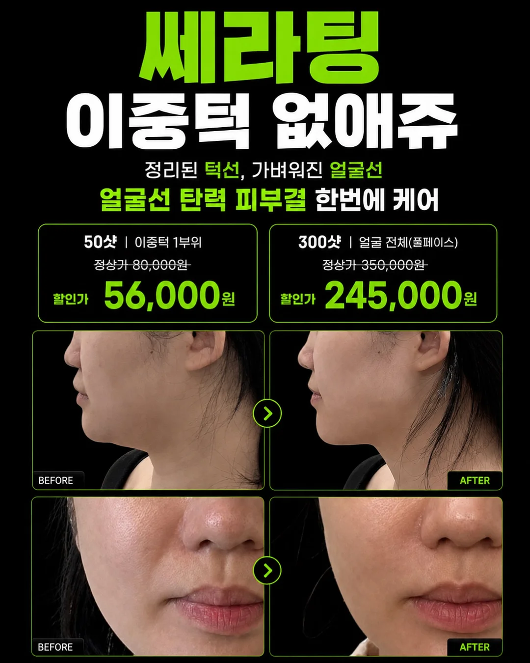 스텐 배수관 거름망 커버 세트