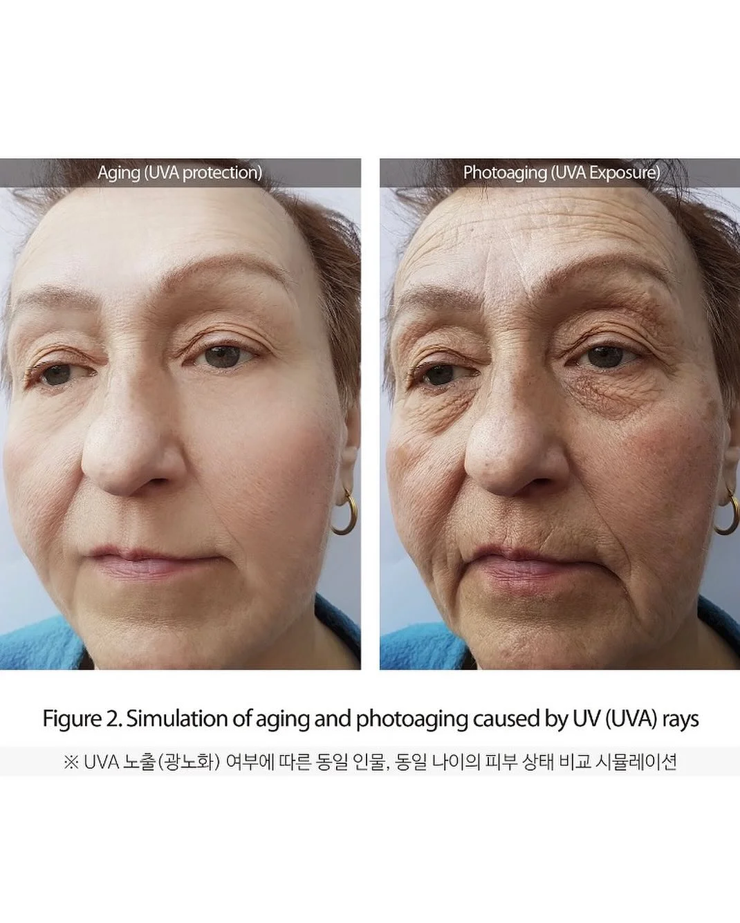 웰스파 미세전류 기기 12