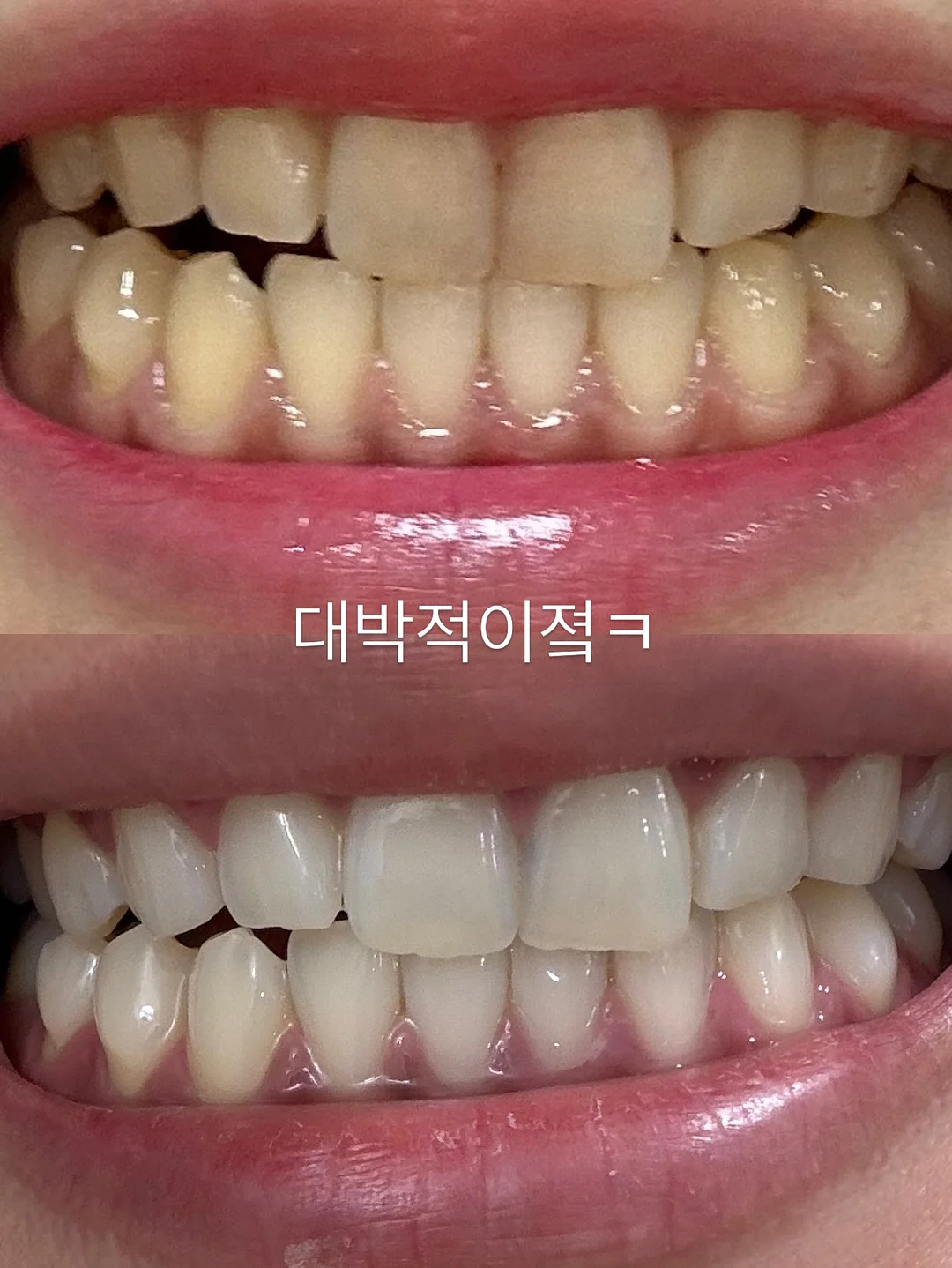 카프리팬츠 4