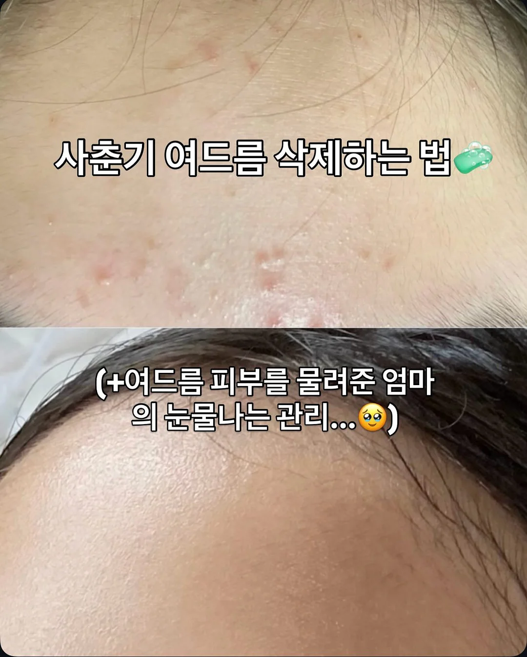 제주 월동무 10kg 1