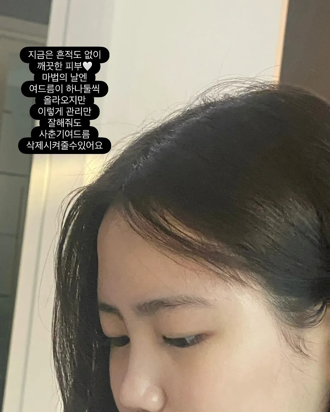 제주 월동무 10kg 11