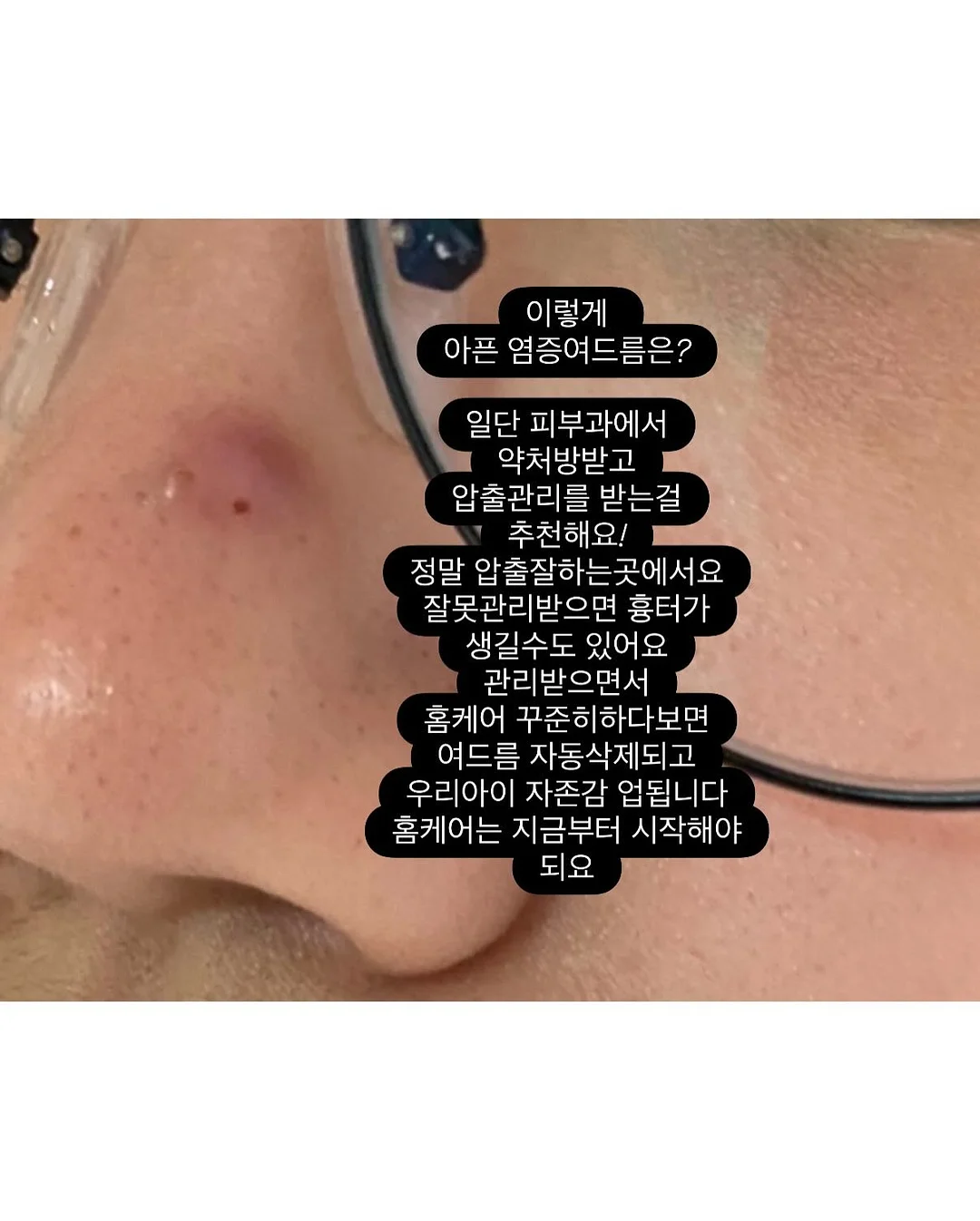 제주 월동무 10kg 10