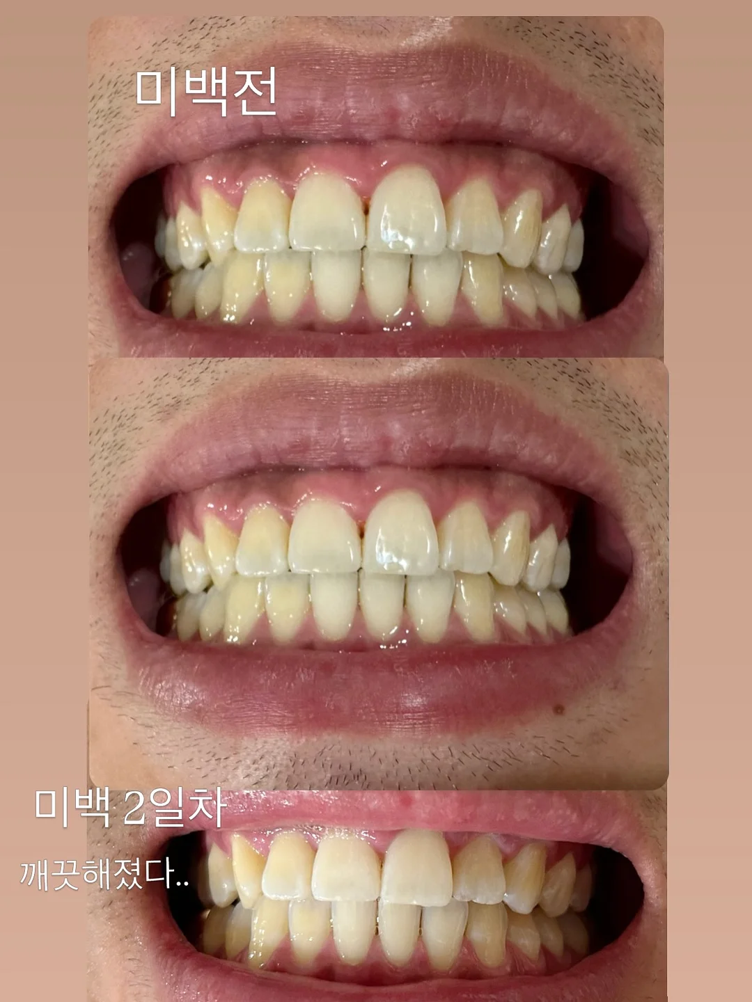 올티모 다이오드 케어 12