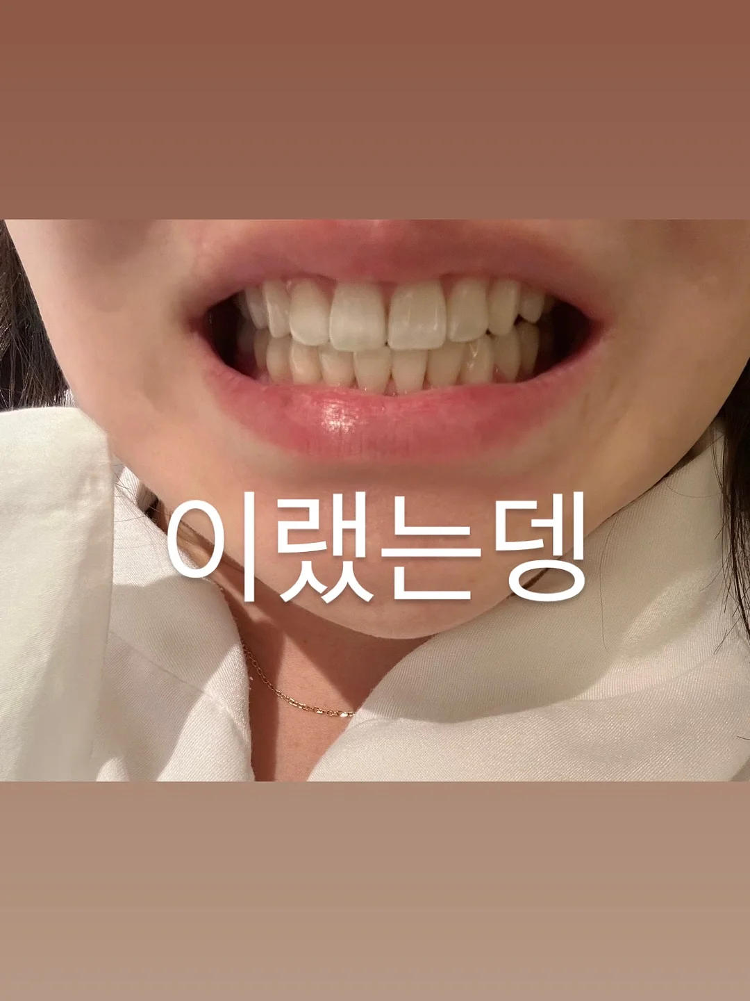 올티모 다이오드 케어 8