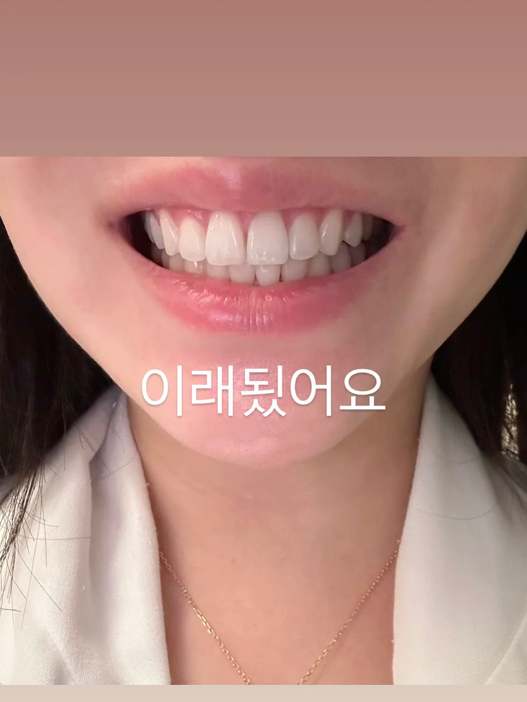 올티모 다이오드 케어 9