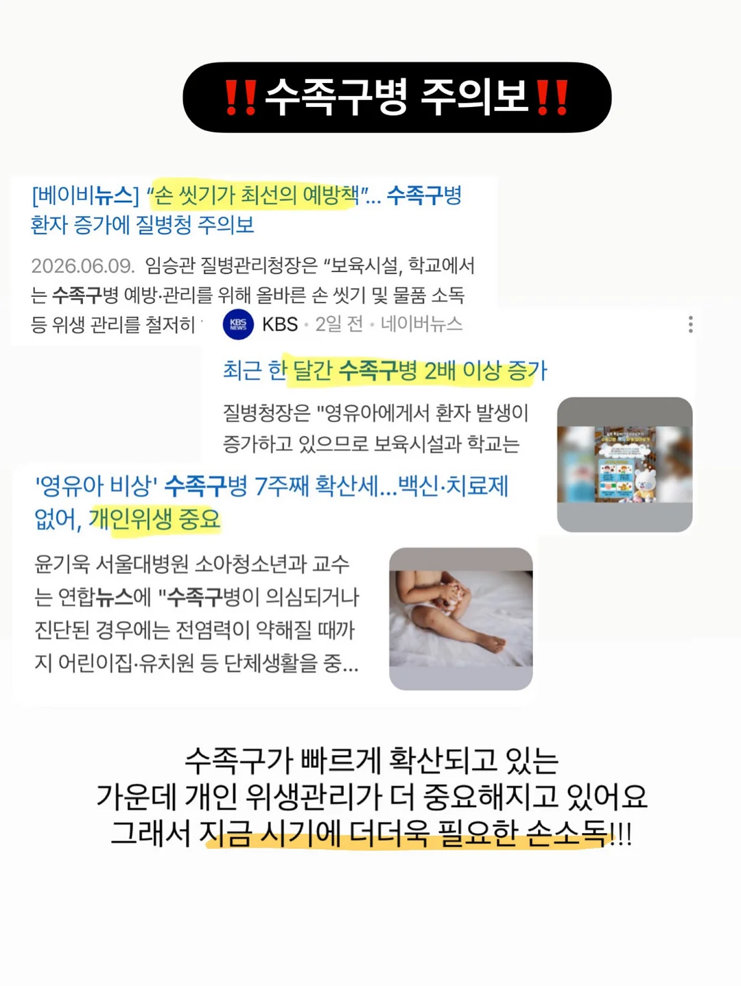 입터짐 방지용 3
