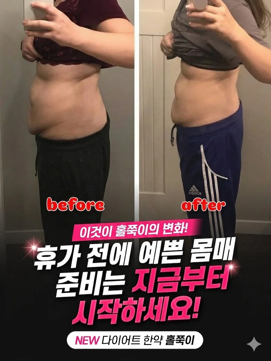 발리 숙소 1
