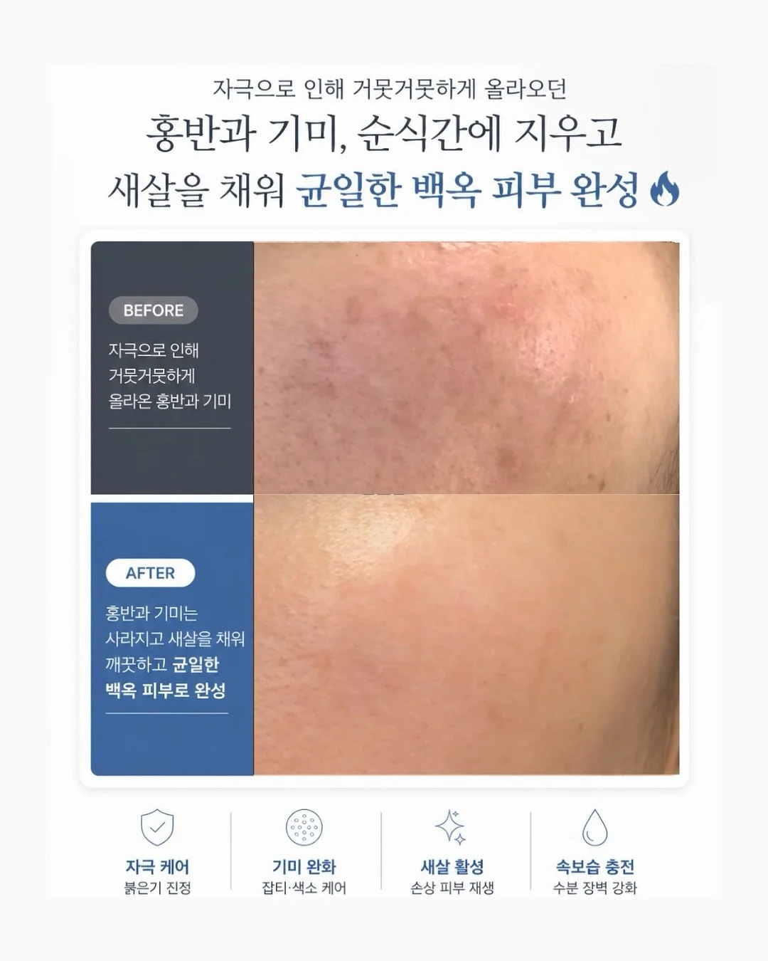 패치 케이스 3