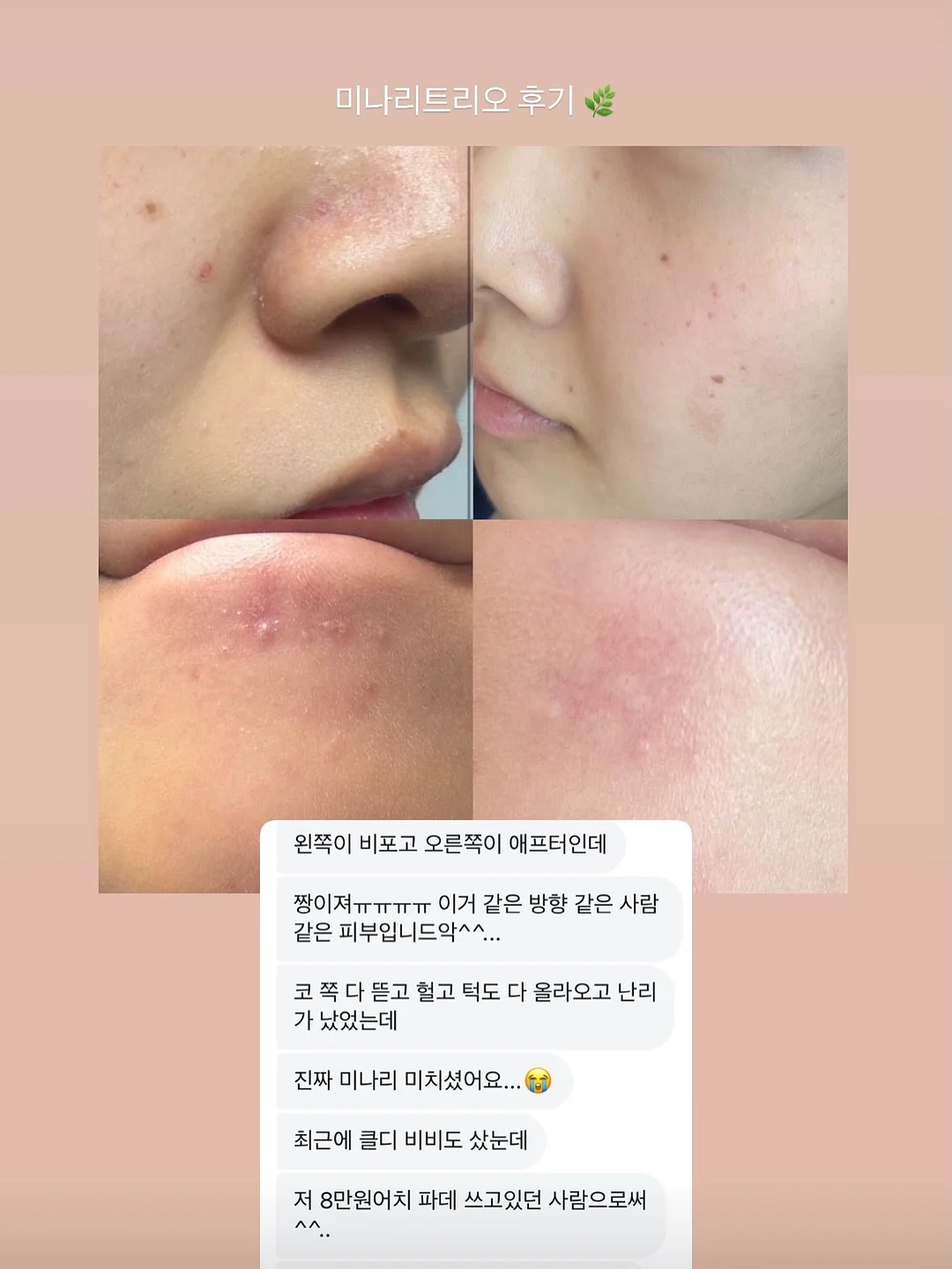 춤추는 오징어 11