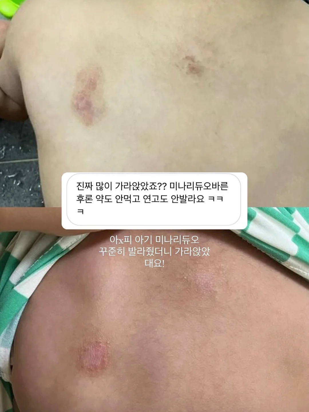 춤추는 오징어 3