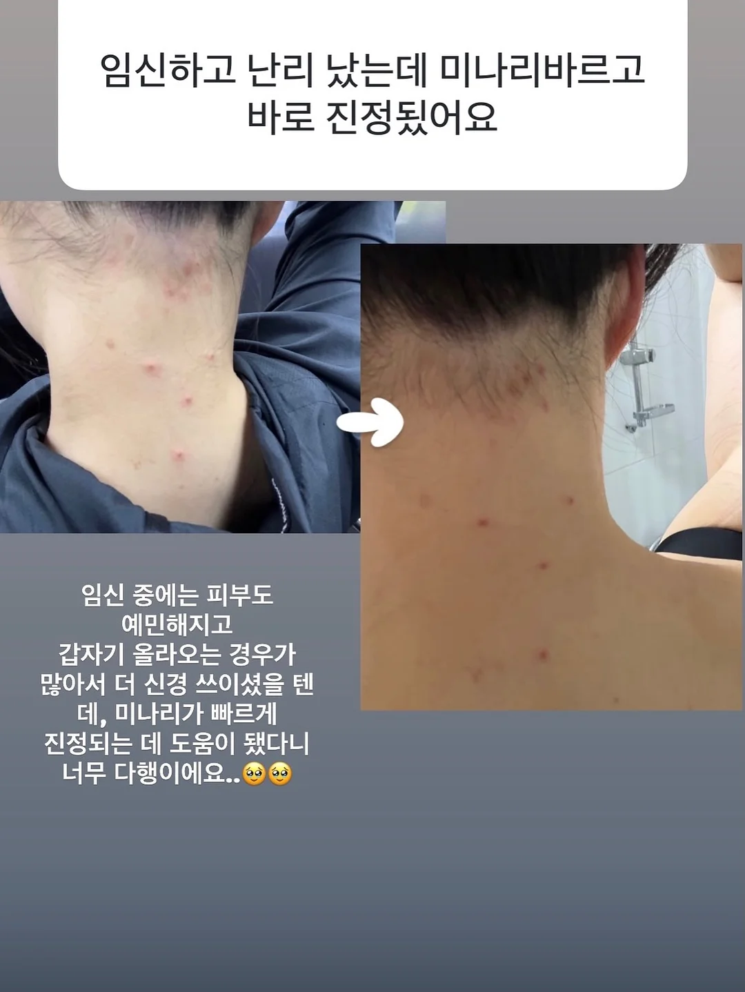 춤추는 오징어 4