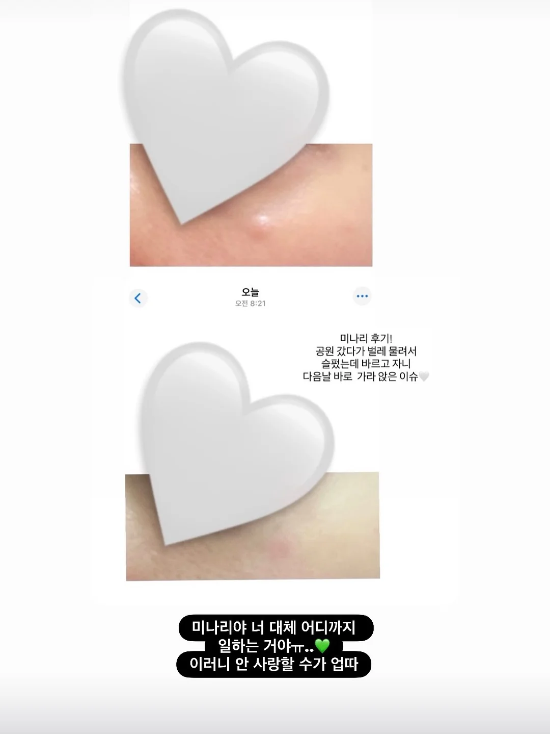 춤추는 오징어 5