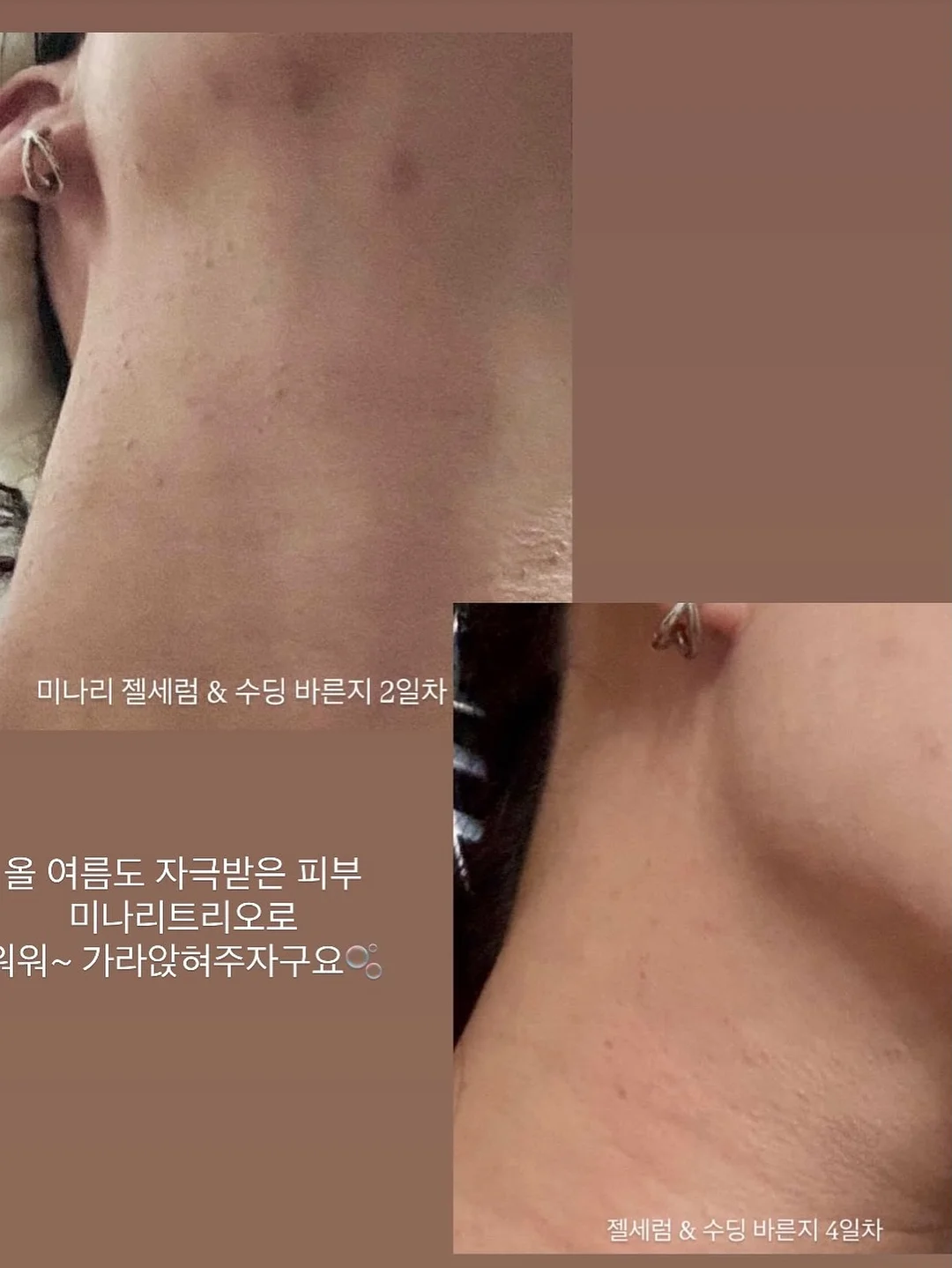 춤추는 오징어 6