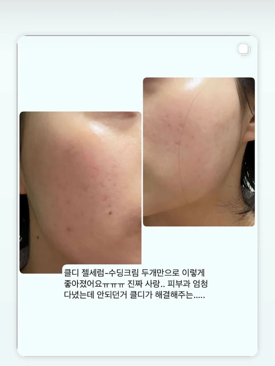 춤추는 오징어 7