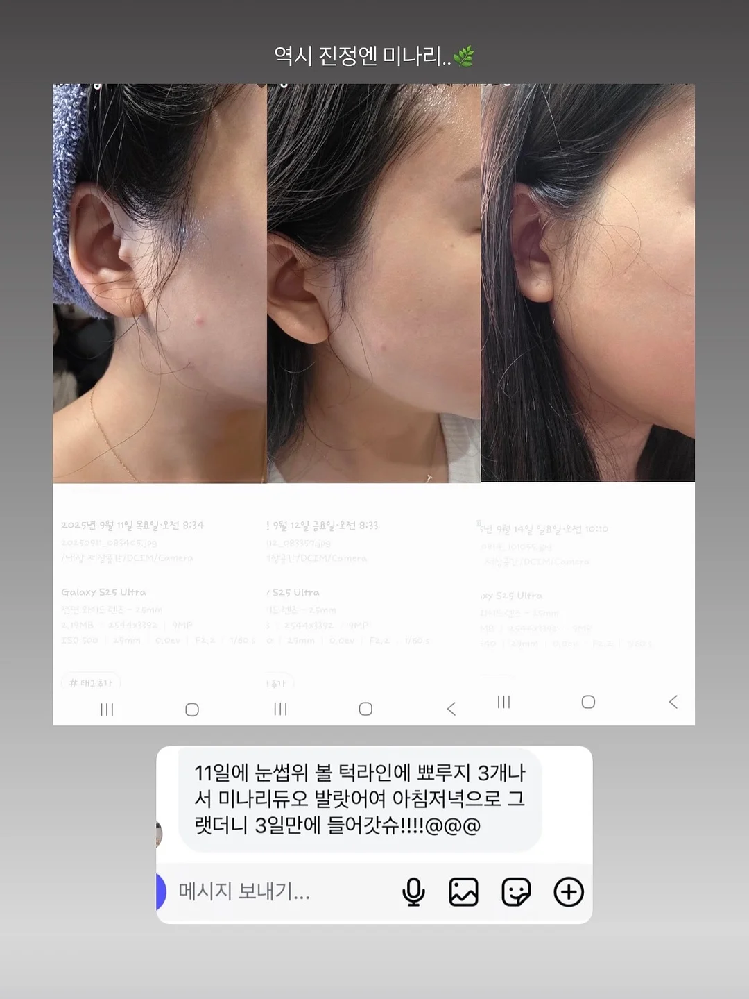 춤추는 오징어 8