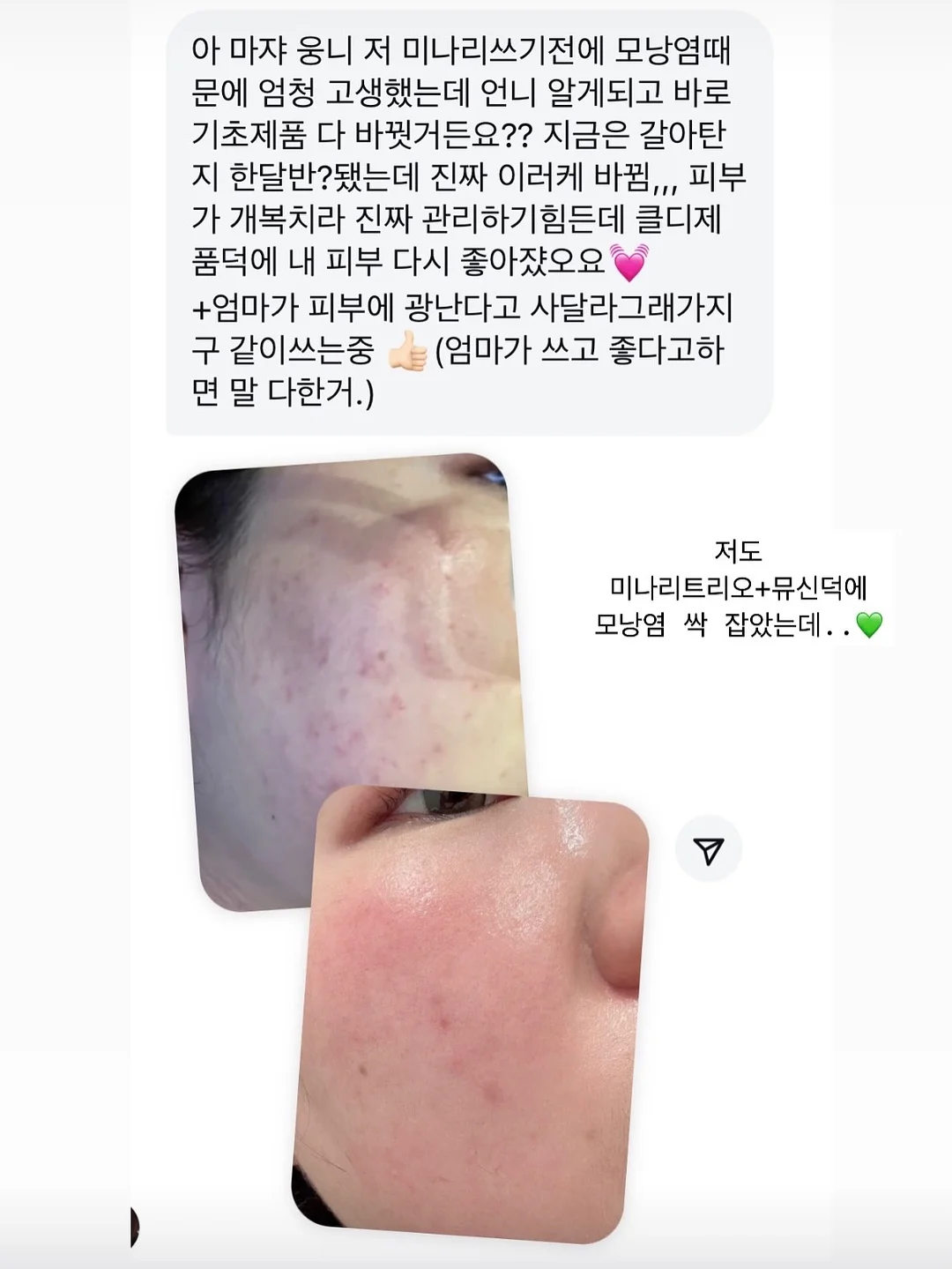 춤추는 오징어 10