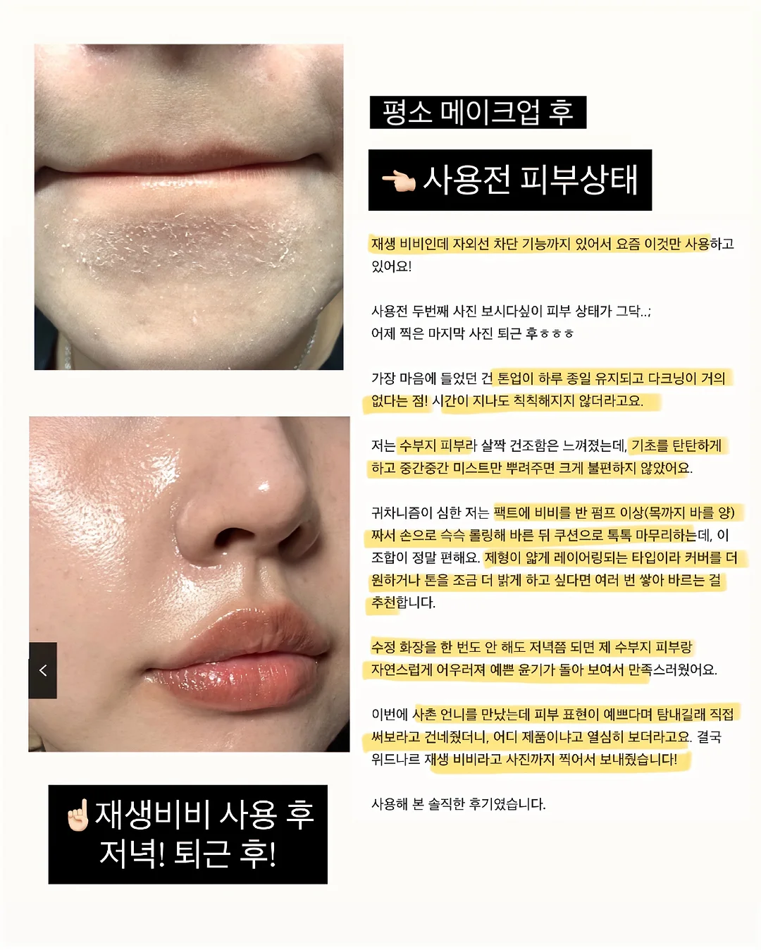 기미 잡티 세럼 4
