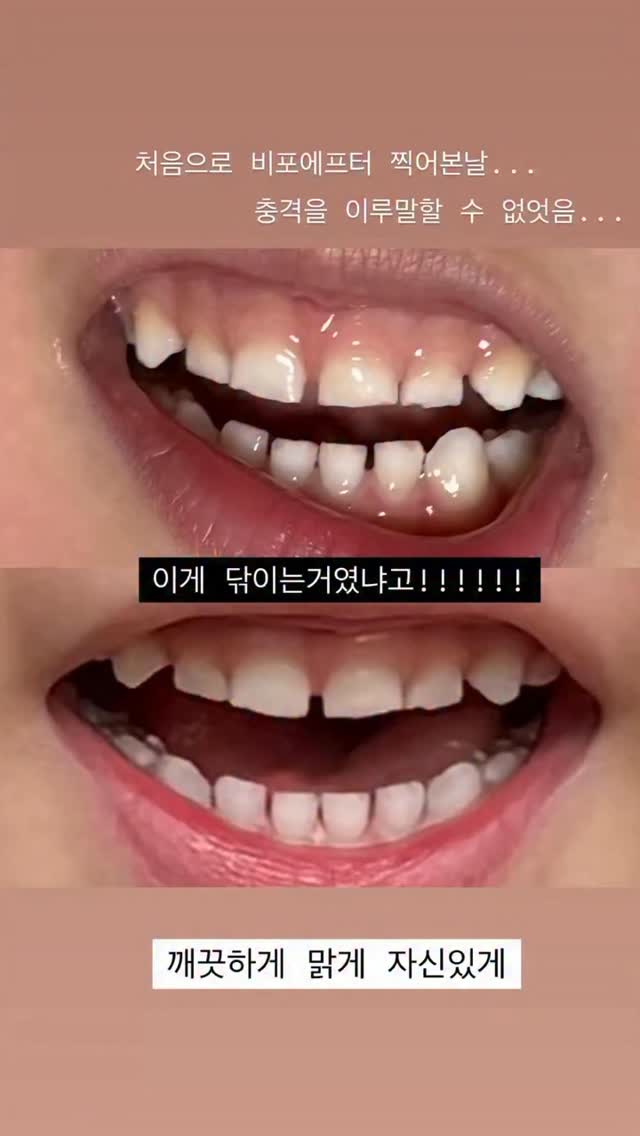 메쉬 후드집업