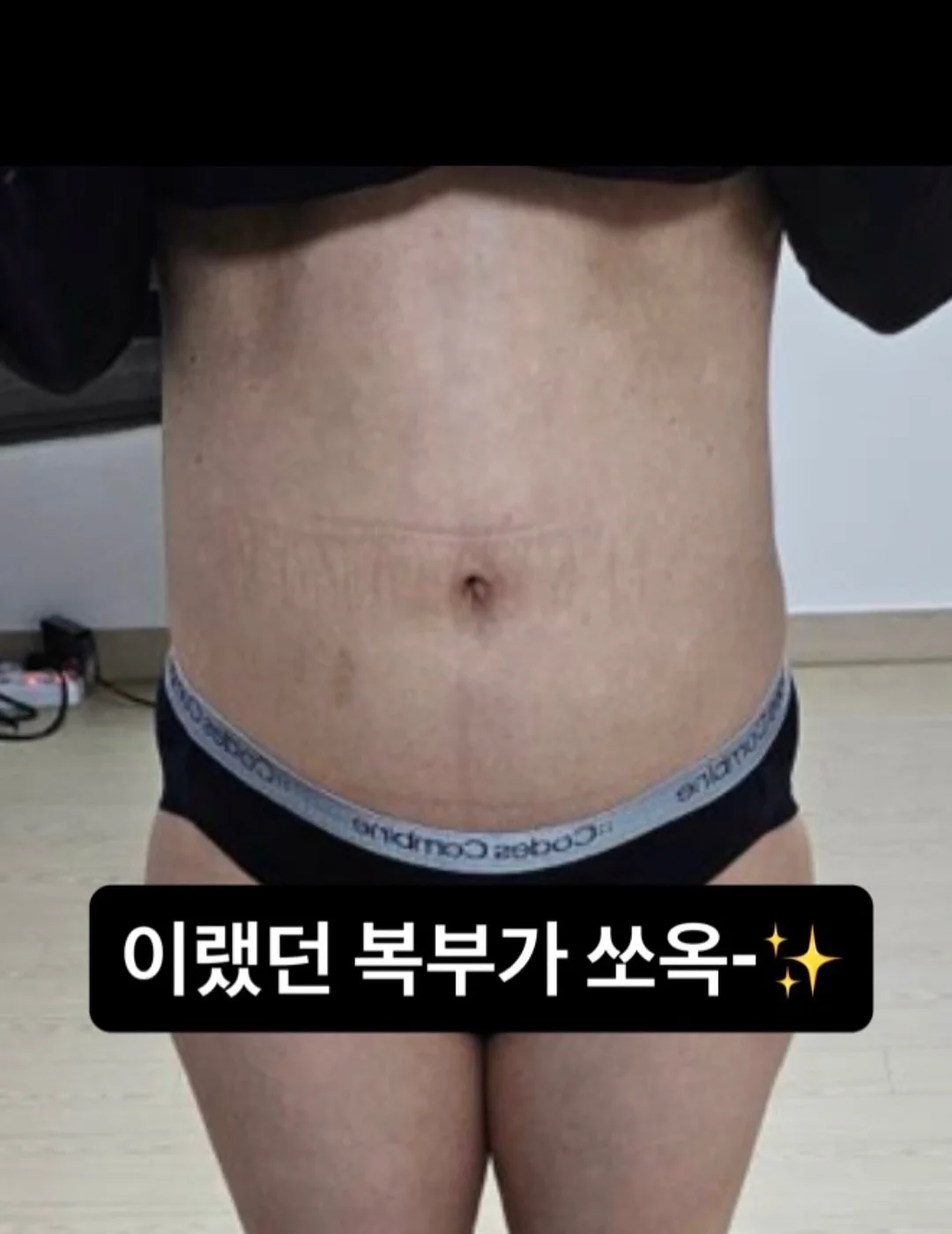 주방 가구 하부장 손잡이 2