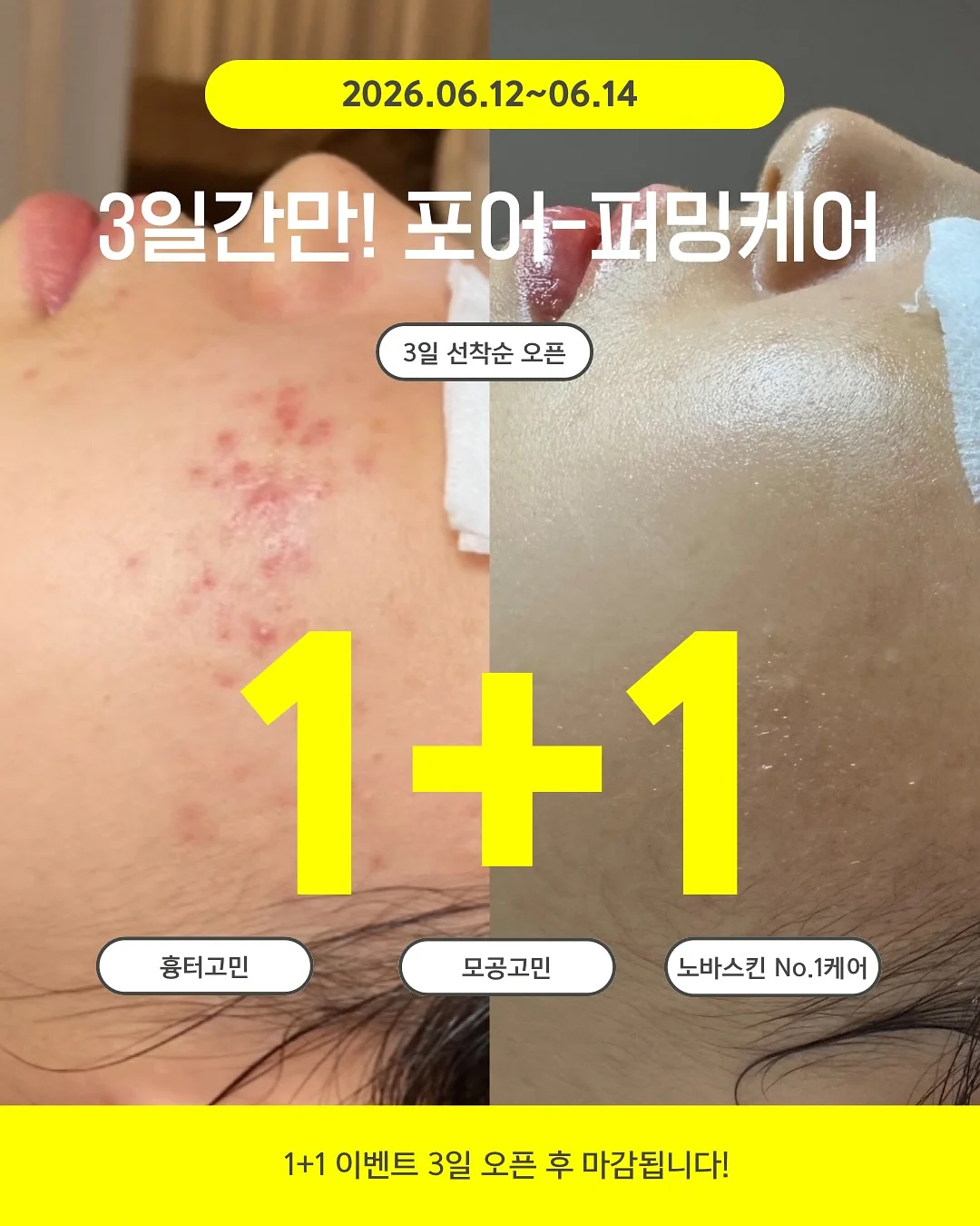 고리링 후르츠팟 1