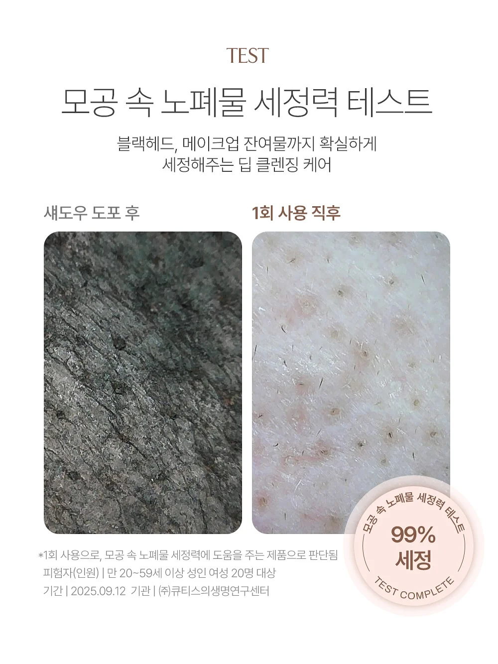국소부위 마사지기 14