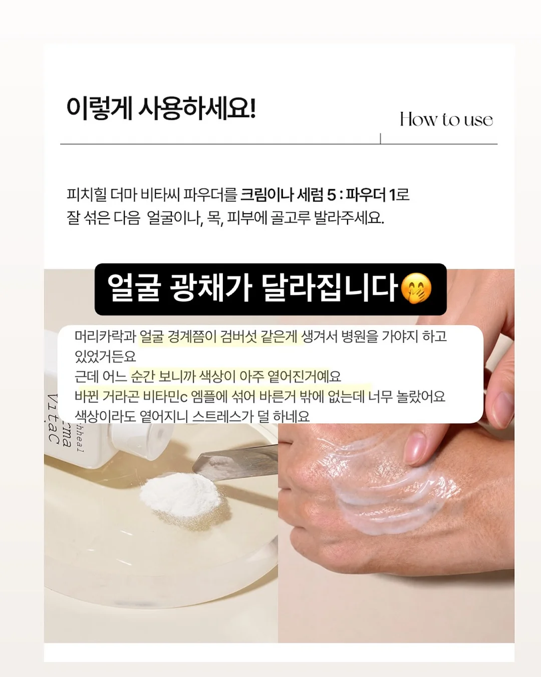 조이드백 9