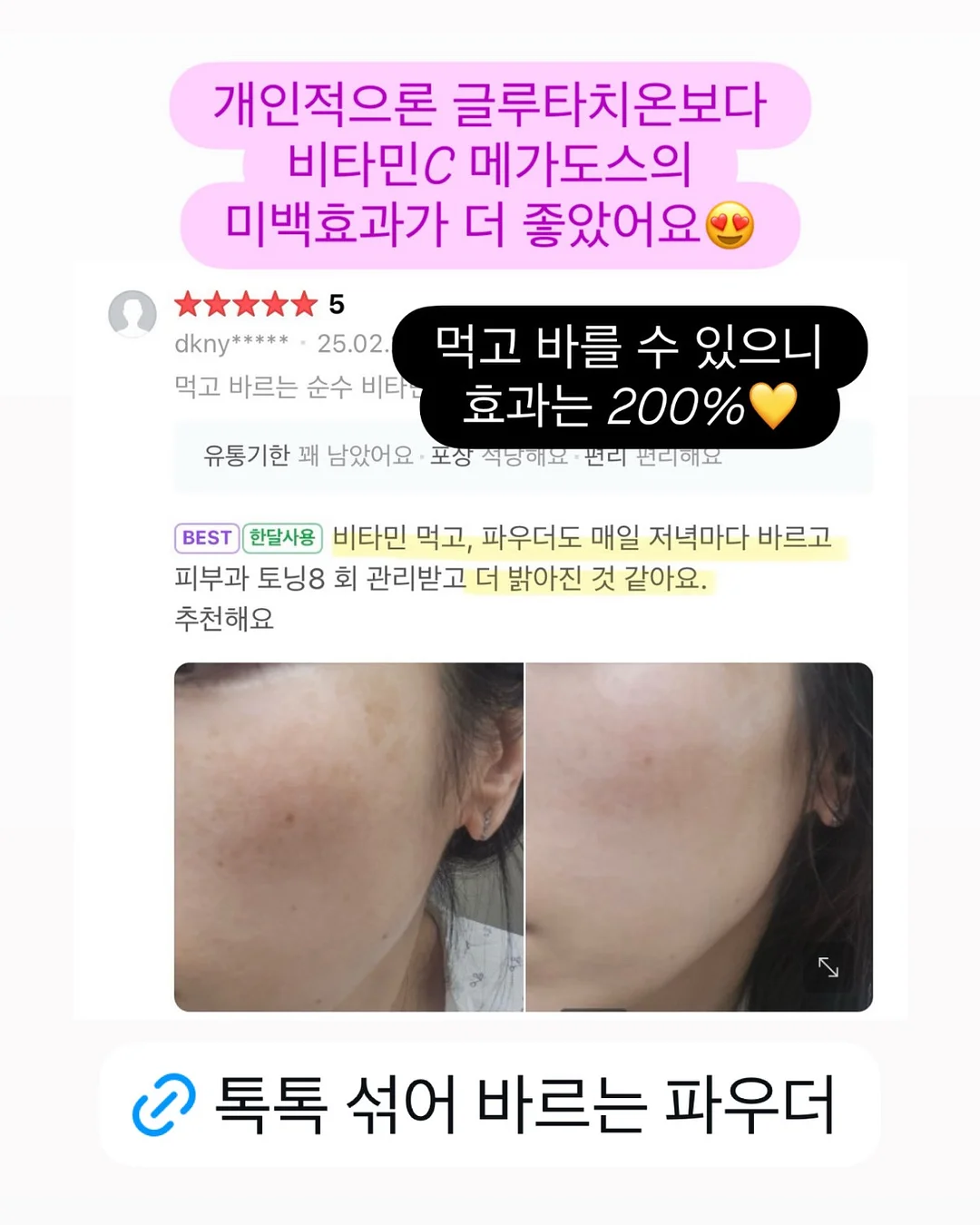 조이드백 10