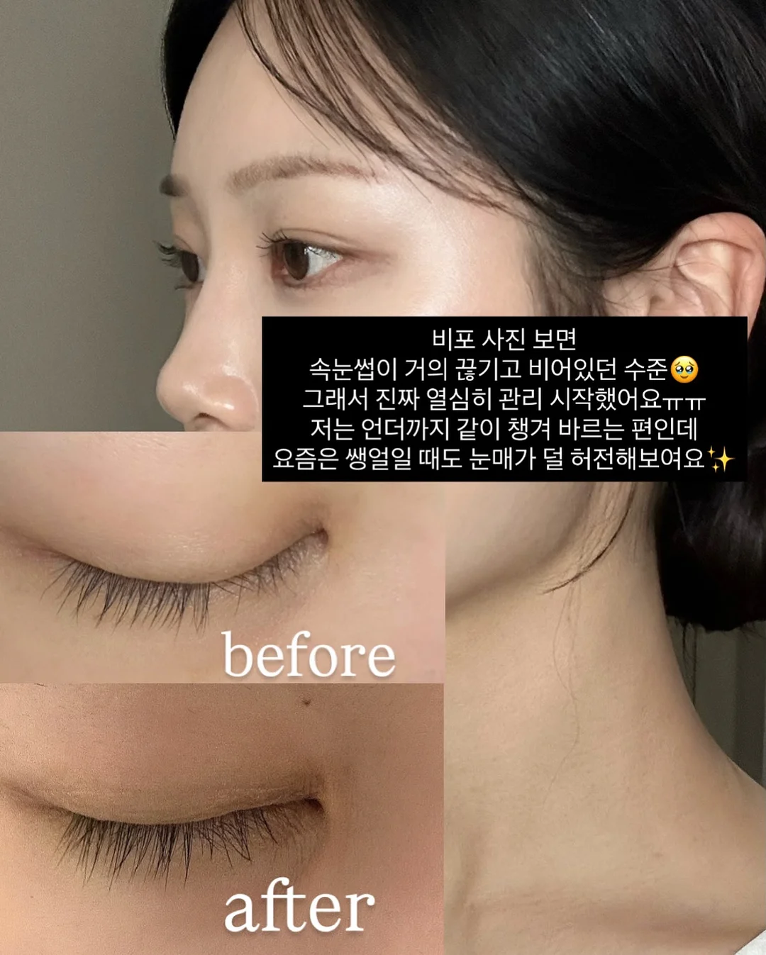 노크존 도입 문의 3