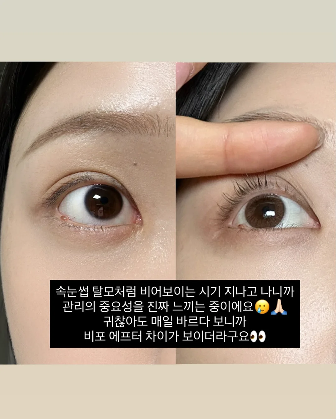 노크존 도입 문의 4