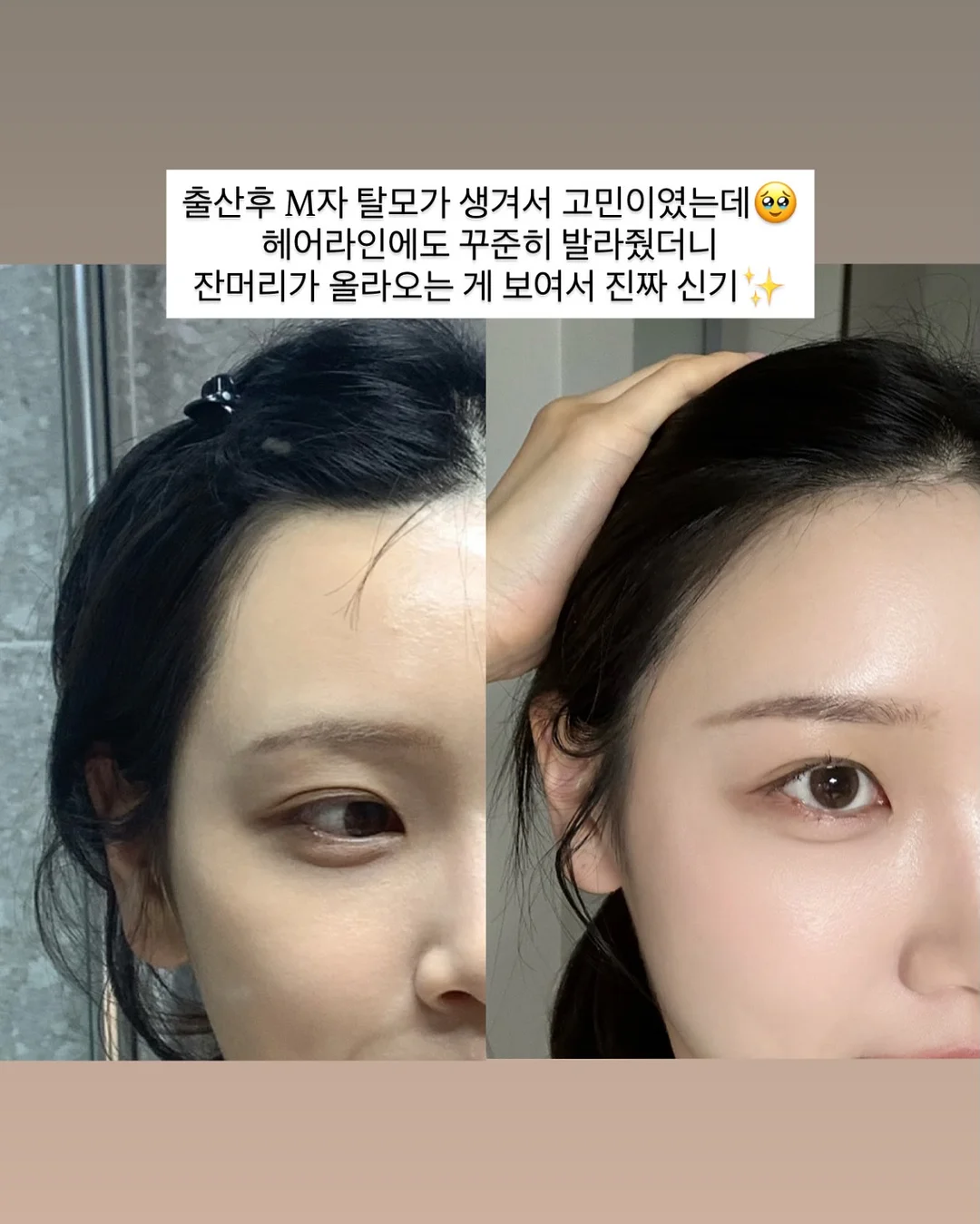 노크존 도입 문의 10