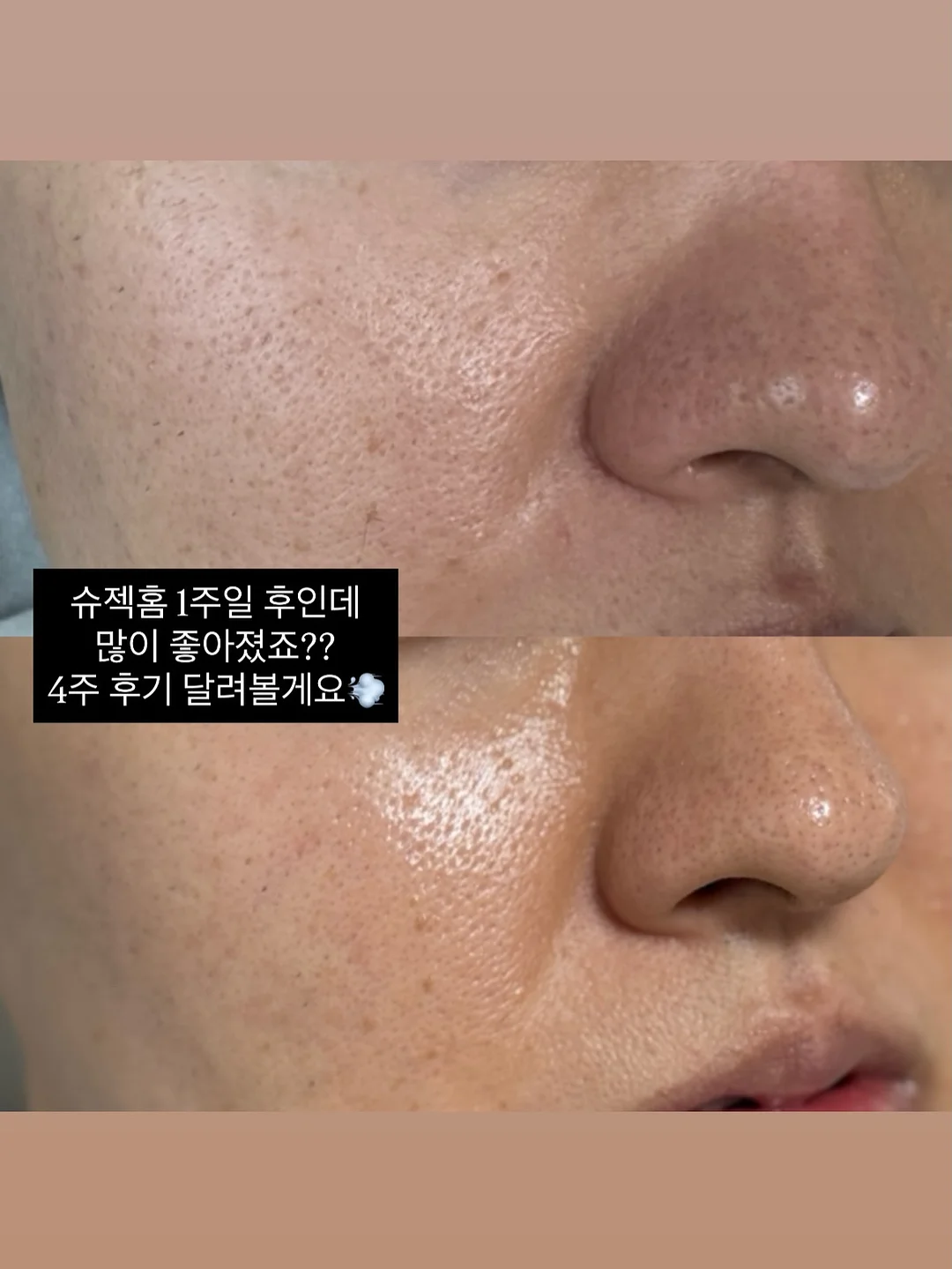 히디프 쿠션&립퐁듀 선물박스 1