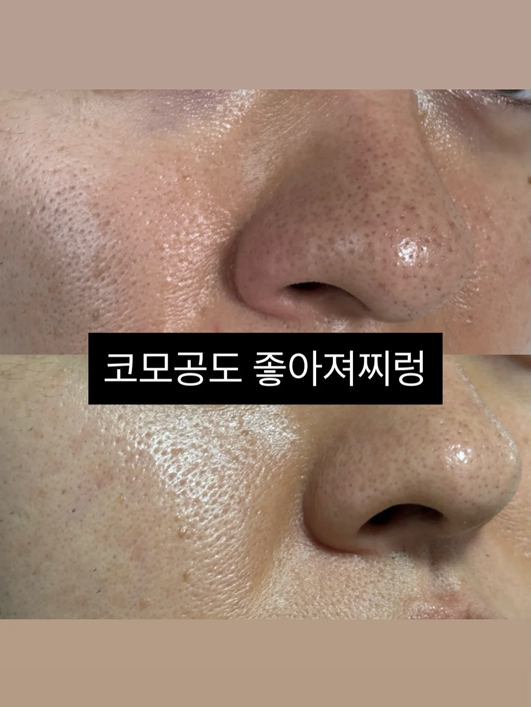히디프 쿠션&립퐁듀 선물박스 2