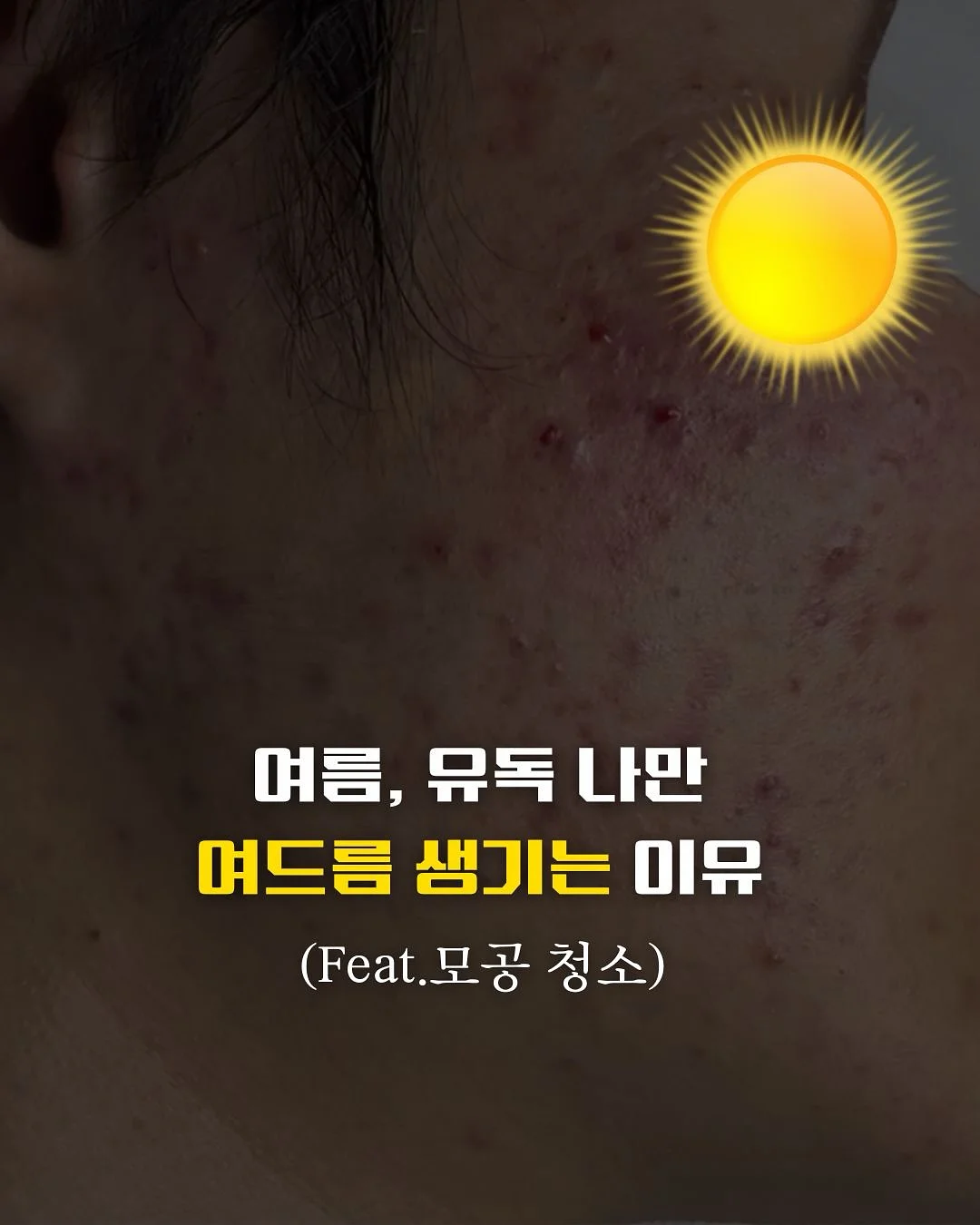 로베네 쫀쫀스판 쉬폰프릴나시 여리핏 가디건 세트 1