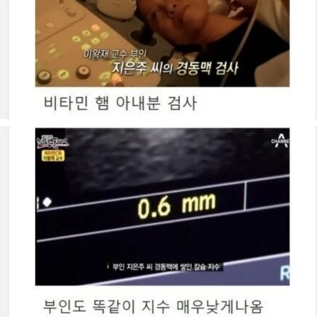 모공·요철 관리템 14