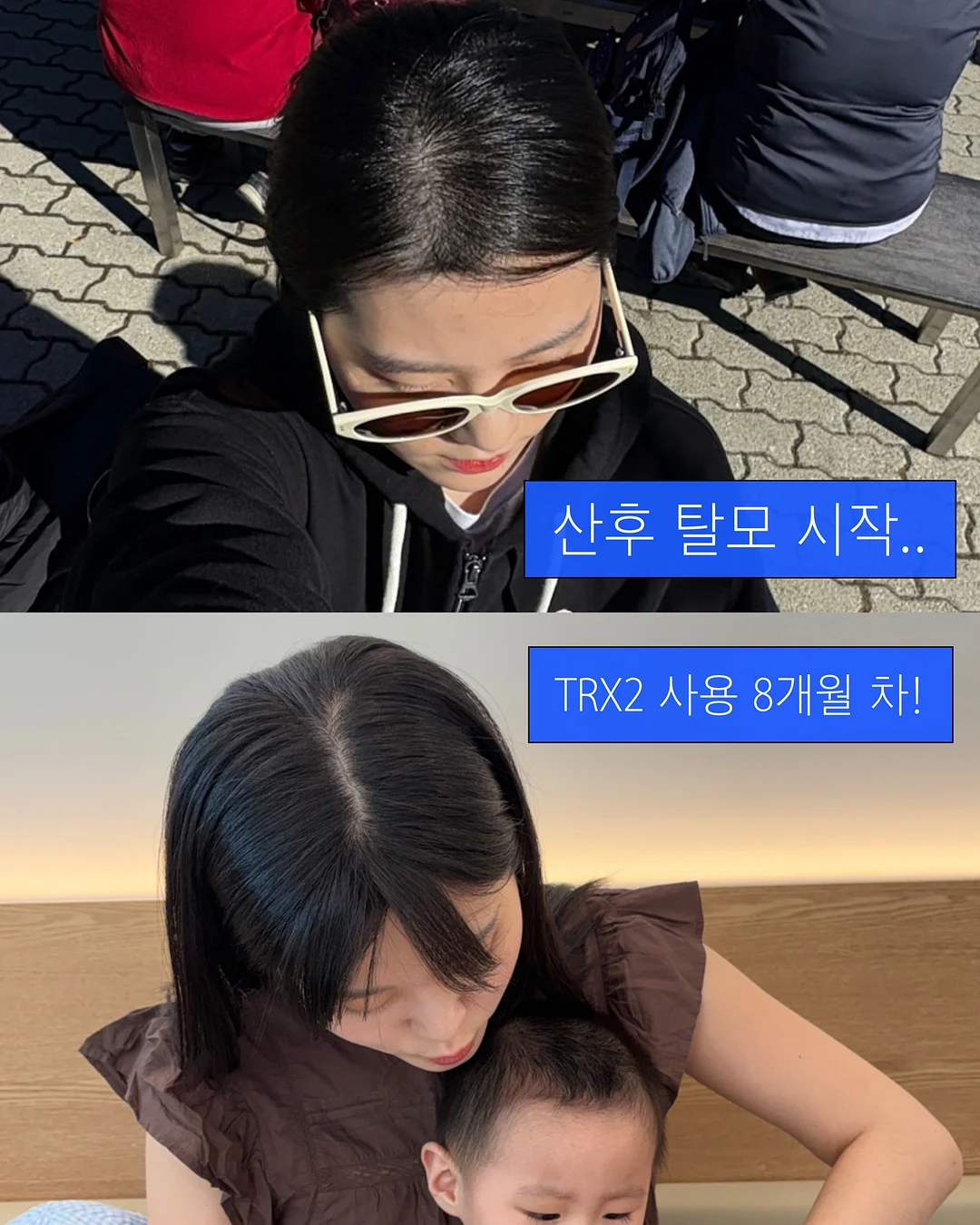 정호영 손질 왕낙지 1