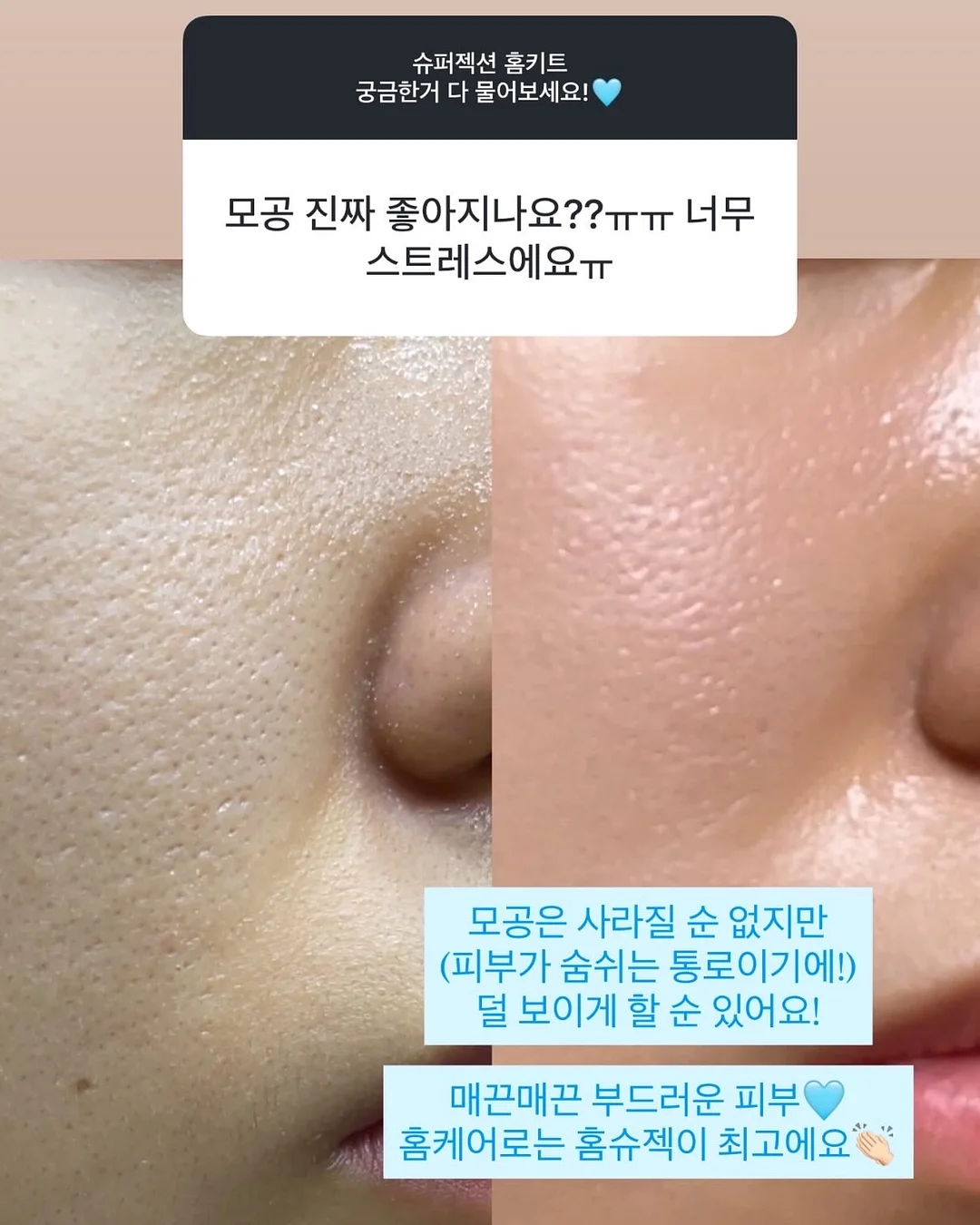 오리지니크 바스캐디 2