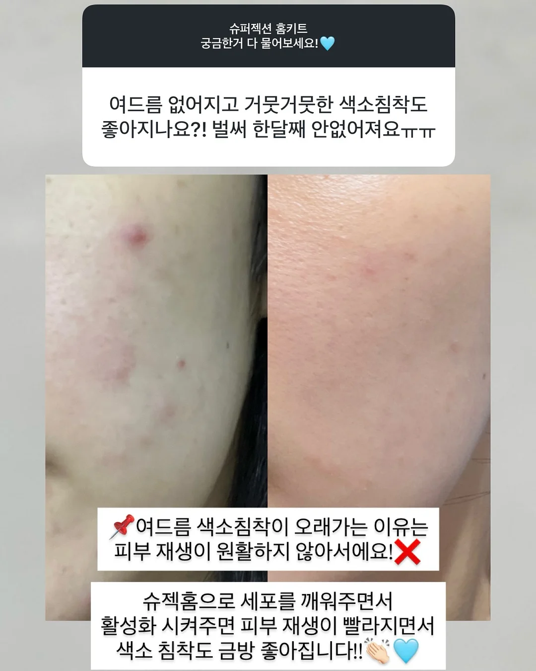 오리지니크 바스캐디 5