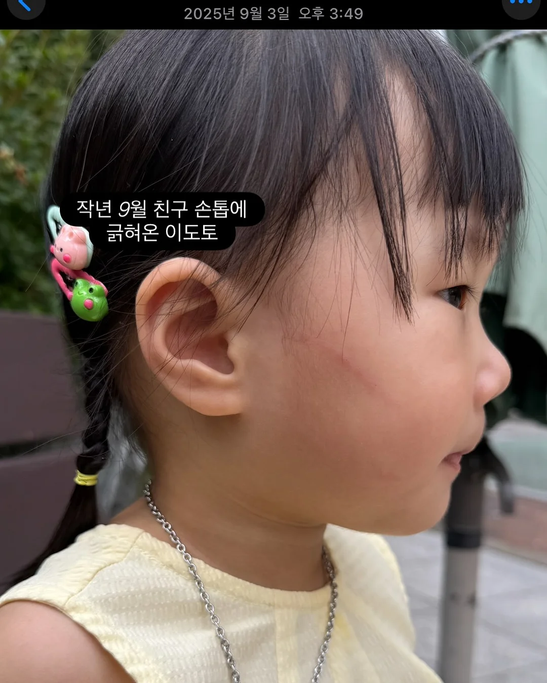 스크런치 6