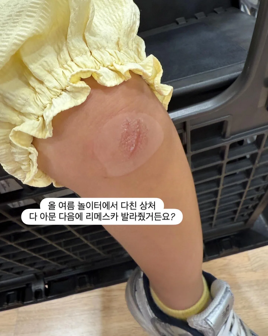 스크런치 8