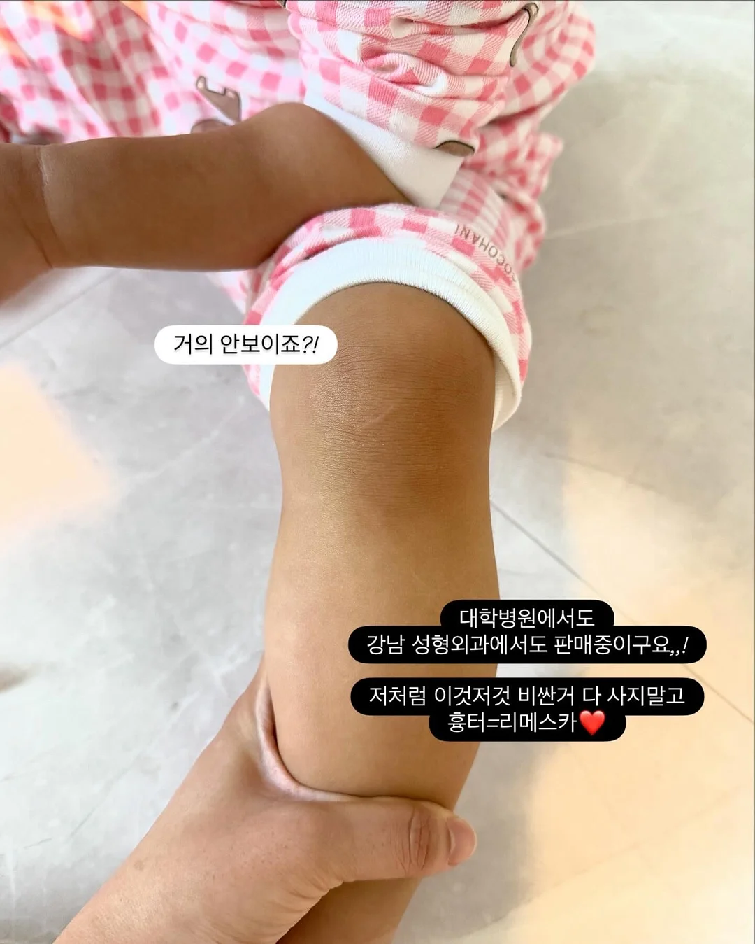 스크런치 9