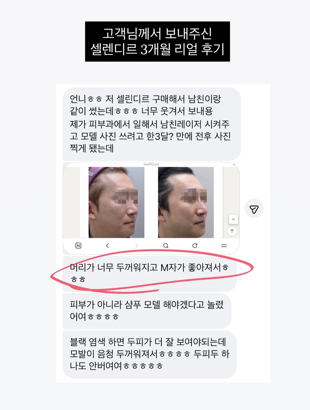 더리틀스 징코 피크노제놀 부스터 2