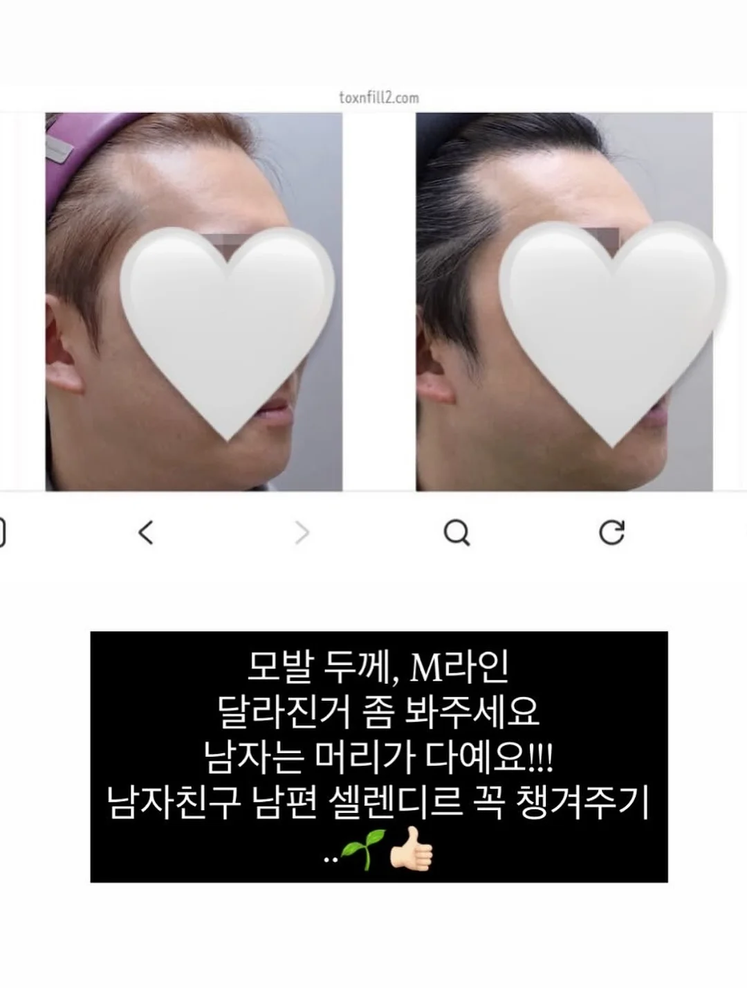 더리틀스 징코 피크노제놀 부스터 3