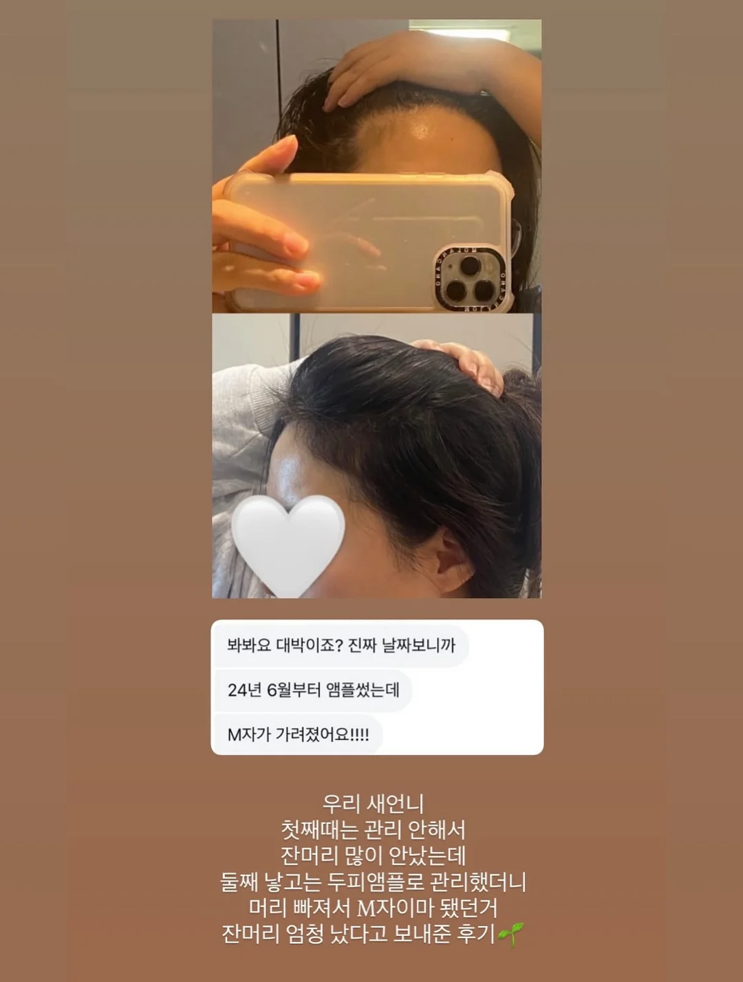 더리틀스 징코 피크노제놀 부스터 4