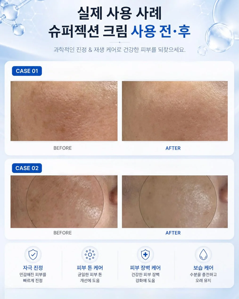 축사 화제를 할아버지께 알리고 죽은 어미소..ㅠㅠ 3