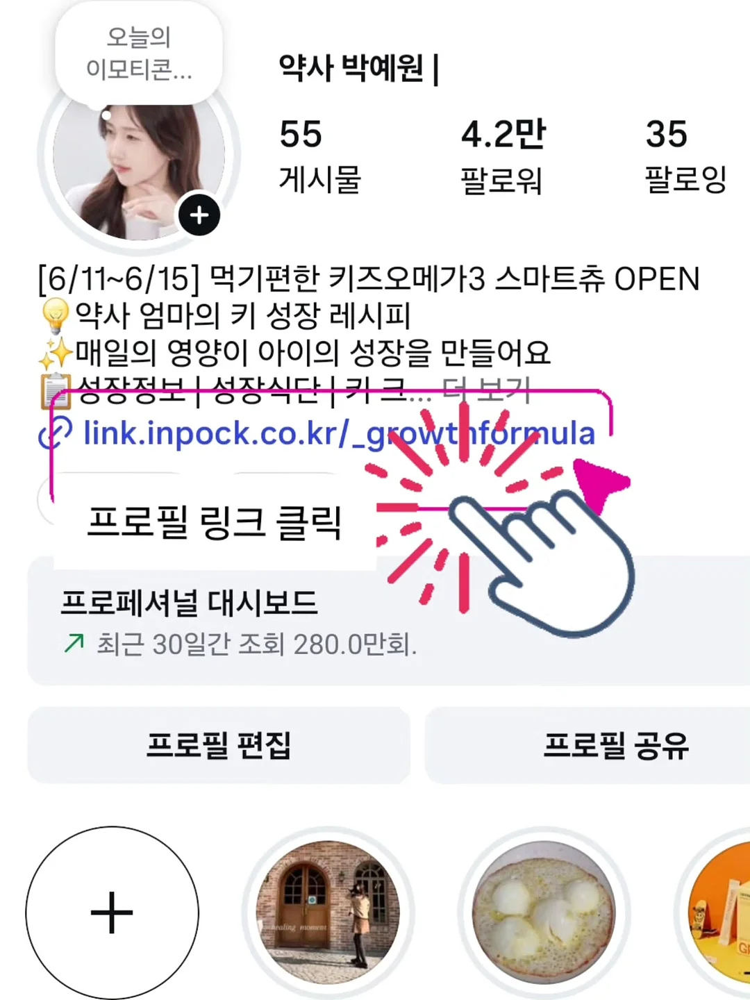 스텐 304 미세 거름망 10